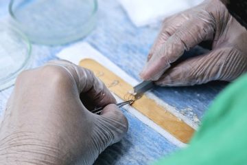 增髮：原因與解決方案的全面分析